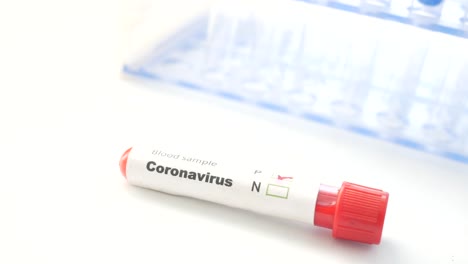 tubo de ensayo de muestra de sangre de coronavirus