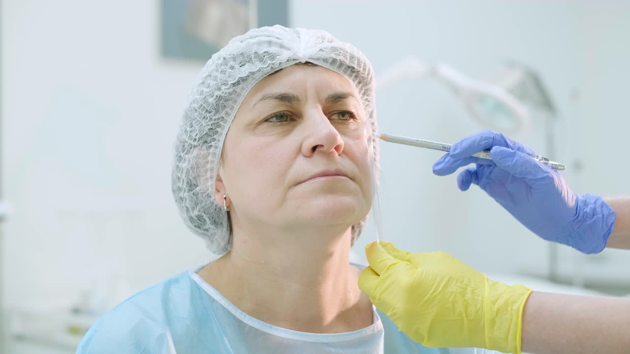 marcado antes de los procedimientos para el rejuvenecimiento de la piel de la cara. cosmetología de hardware profesional