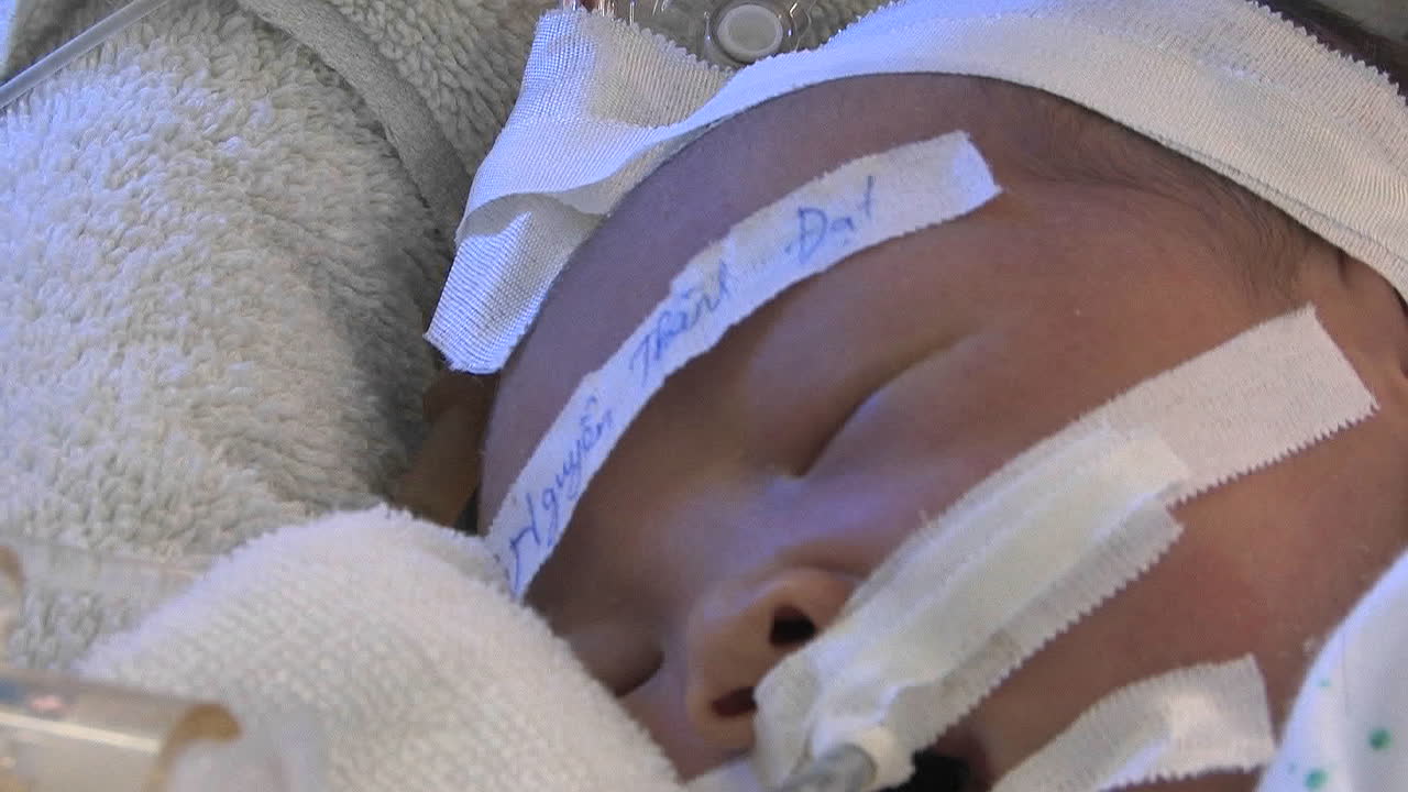 Neonato che dorme in un ospedale