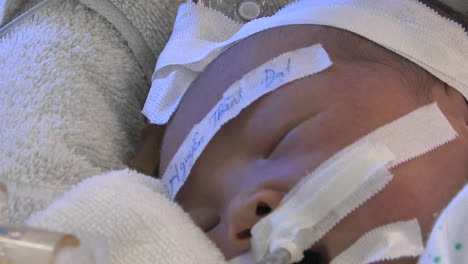 newborn baby sleeping in a hospital