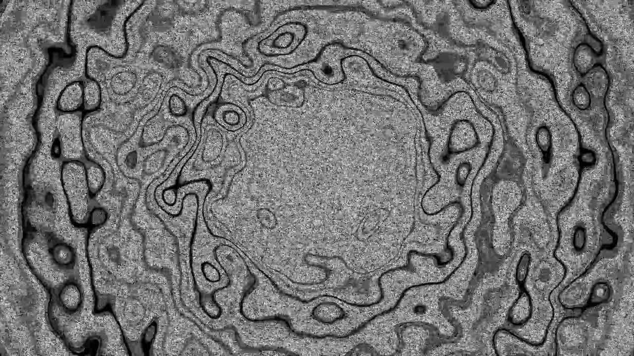ondulación circular psicodélica 10