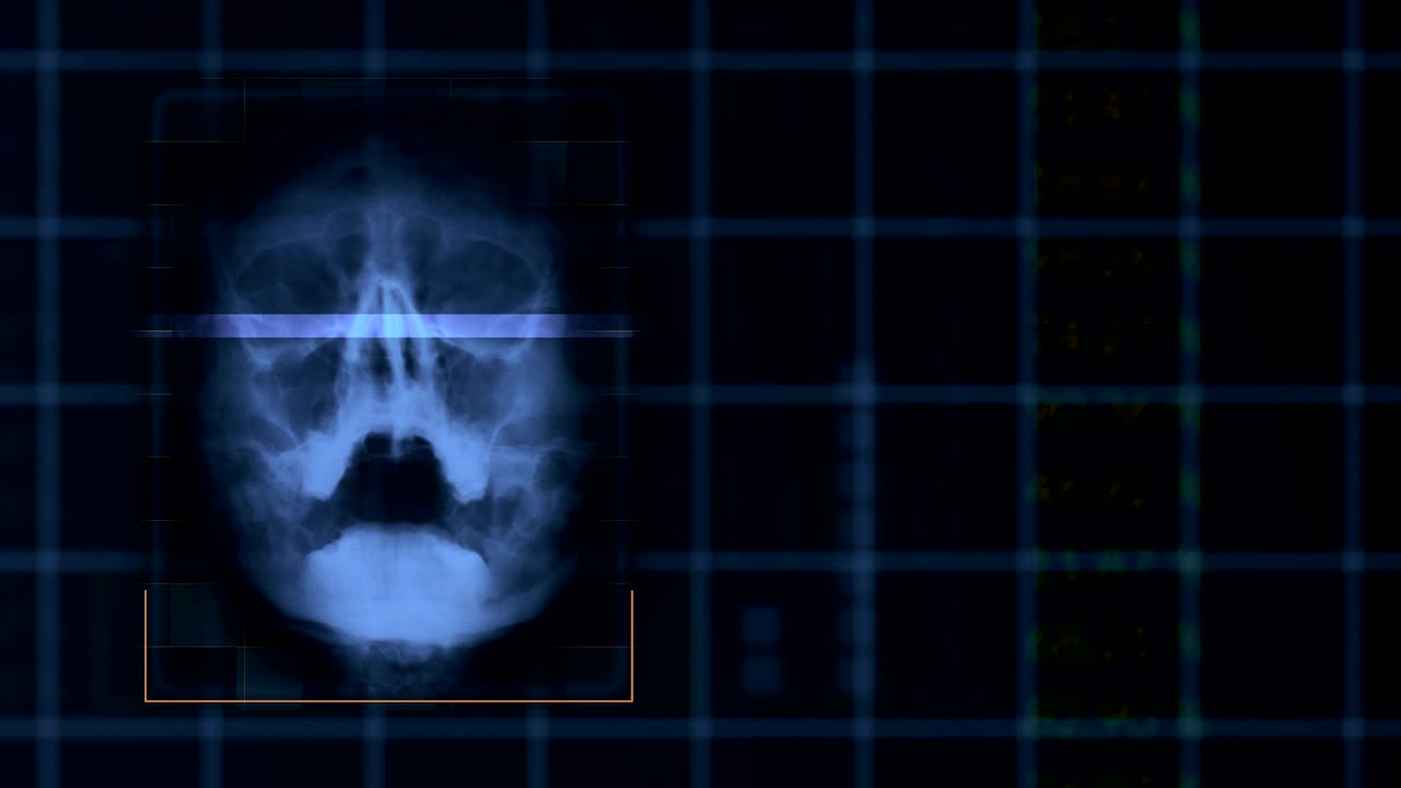 Scan of a human skull, looped Blue hud interface medical equipment