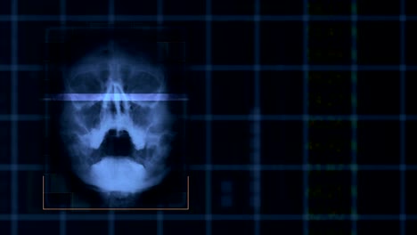 scan of a human skull, looped blue hud interface medical equipment