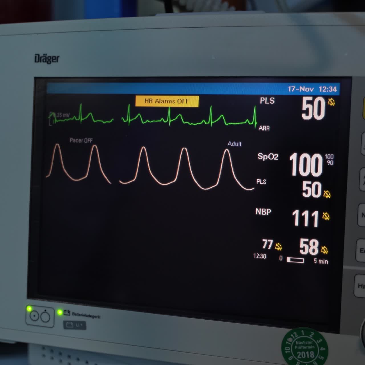 Hospital cardiogram examination. Monitoring patient healthcare on monitor