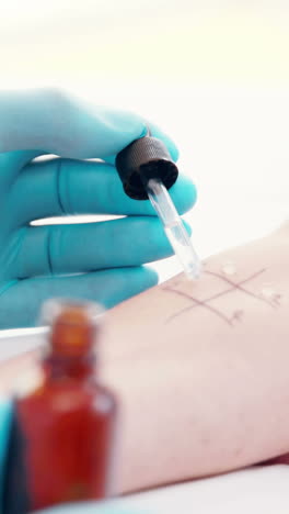 médico haciendo una prueba de pinchazo en la piel de su paciente