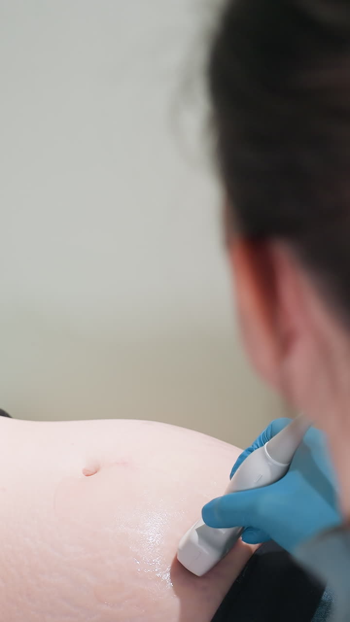 primer plano de un ecografista blanco escaneando el abdomen con una sonda manual y gel, mano enguantada firme en el torso, paciente prenatal reclinada, iluminación clínica suave, profesional concentrado realizando el diagnóstico