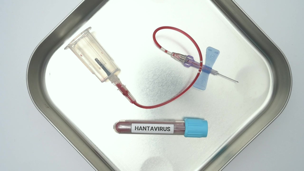 Provetta per test sanguigno dell'Hantavirus accanto a un ago a farfalla e un vacutainer su un vassoio chirurgico