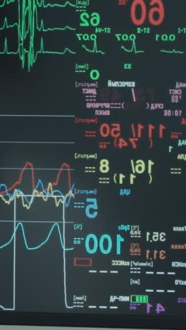 digitale levensindicatoren op monitor. geavanceerde digitale technologie bewaakt en controleert de vitale kenmerken van de patiënt tijdens een bypassoperatie van de kransslagader