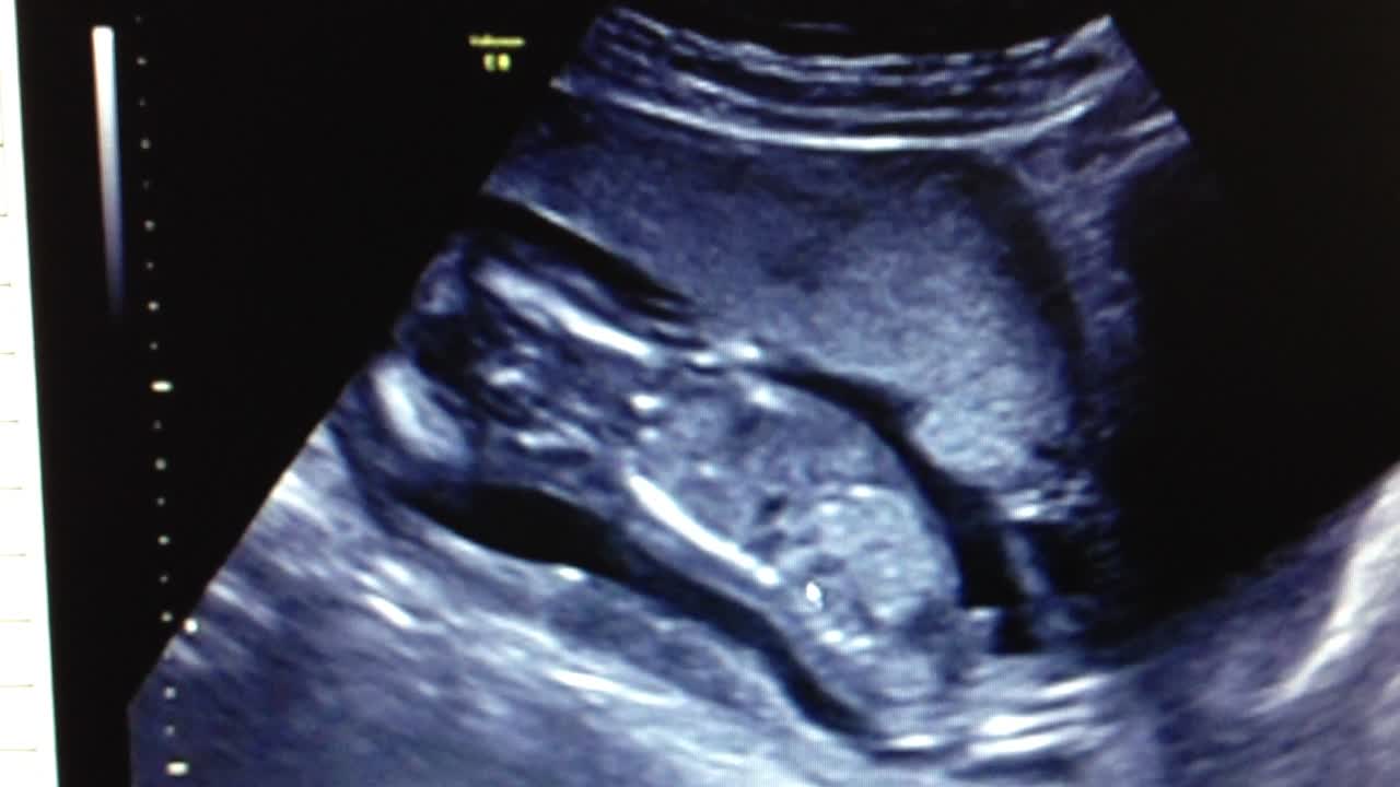 È un maschietto! Un'ecografia in bianco e nero che rivela il sesso del feto in via di sviluppo all'interno dell'utero materno.