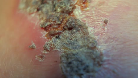 a macro shot of a scab on a knee