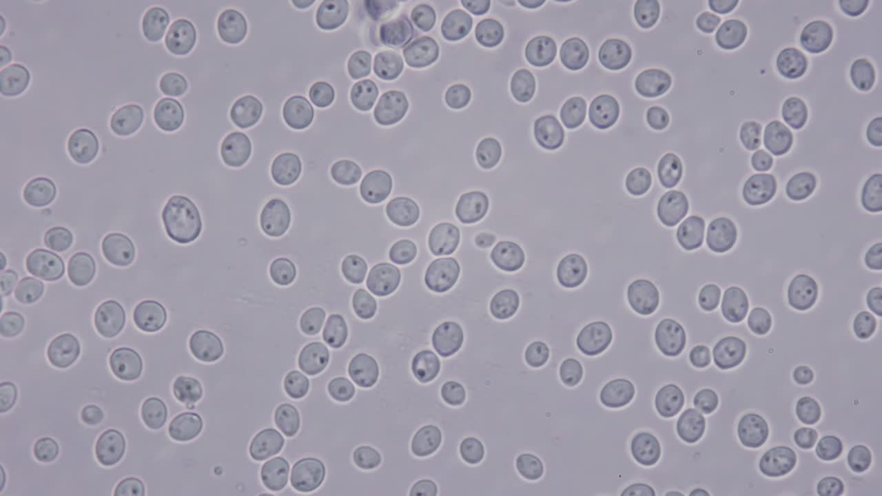fotografía muy detallada de bacterias de levadura. magnificación al microscopio 1000 veces. reciclaje de alimentos y residuos no alimentarios en etanol