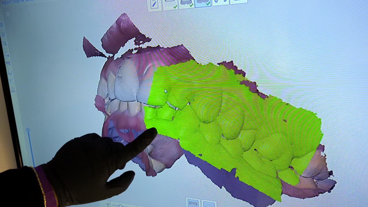 Digital dental scan being reviewed