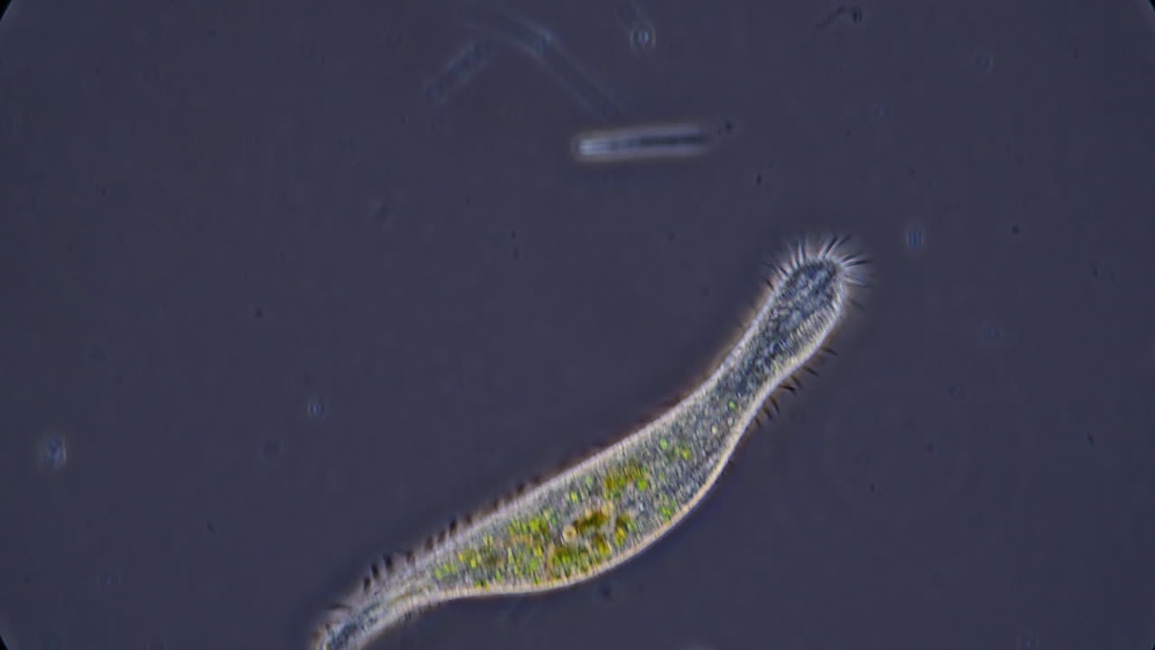 Microscopic view of a ciliate microorganism