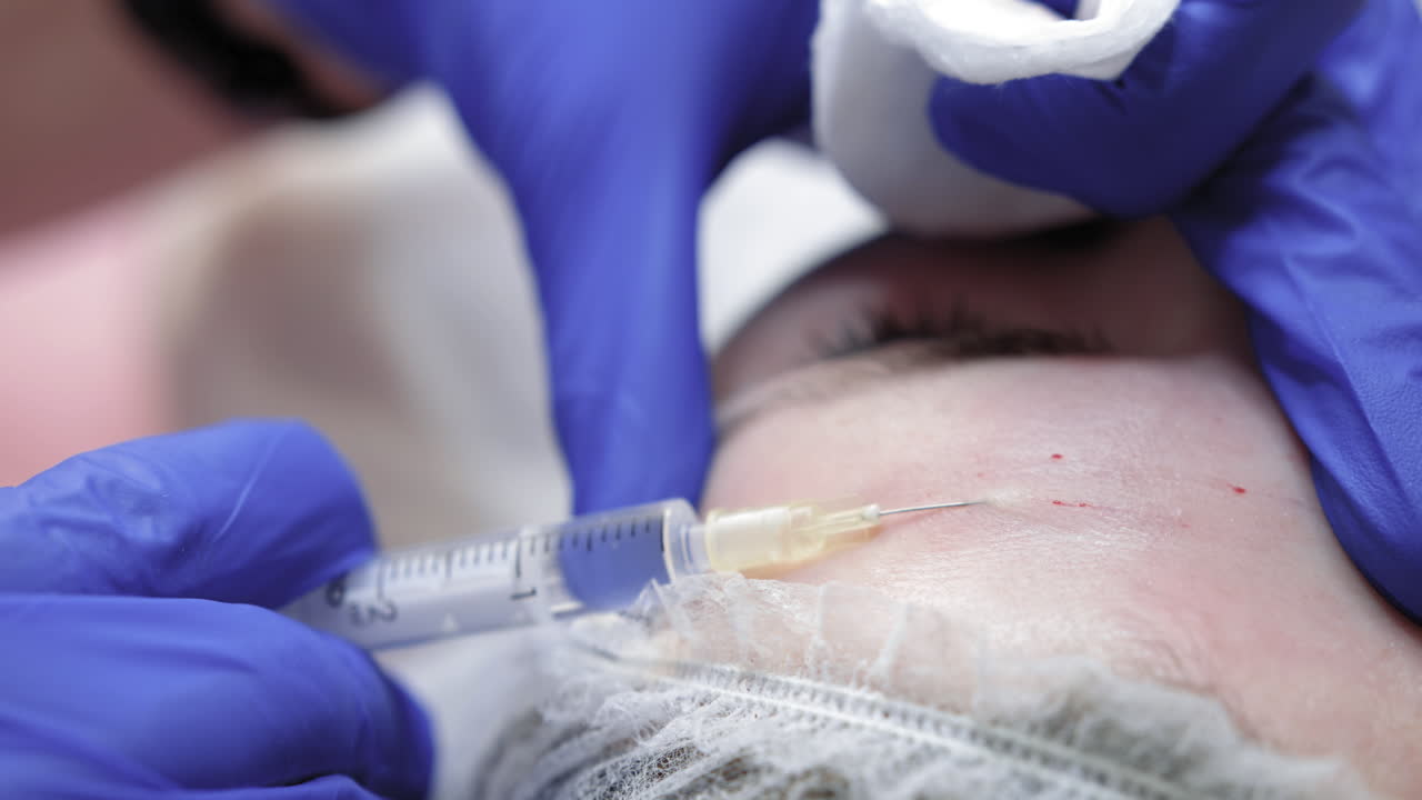 Botox- og collageninjektioner til skønhed: Midaldrende kvinde får foretaget skønhedsinjektioner