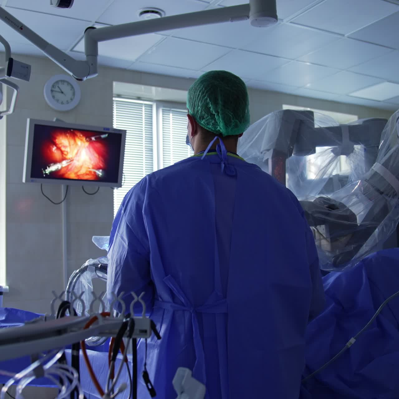 Surgical operation performed with the help of robotic equipment. Doctor stands his back to the camera looking at the screen on the wall in front of him