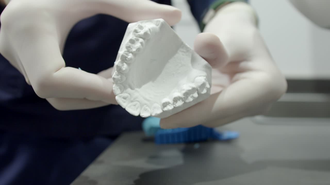 전문 정형 치과 의사가 플라스치 인상을 보여줍니다.