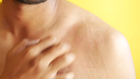 hombre rascándose con picazón en el hombro erupción