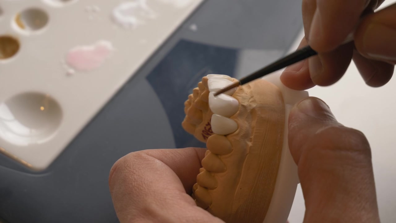 Close-up de mão pintando detalhes em um molde dentário com um pincel fino