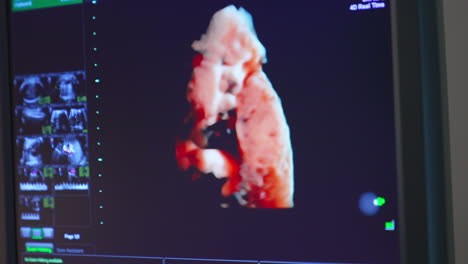 ultrasound apparatus at work. screen showing the moving organ at ultrasonic check up. close up.