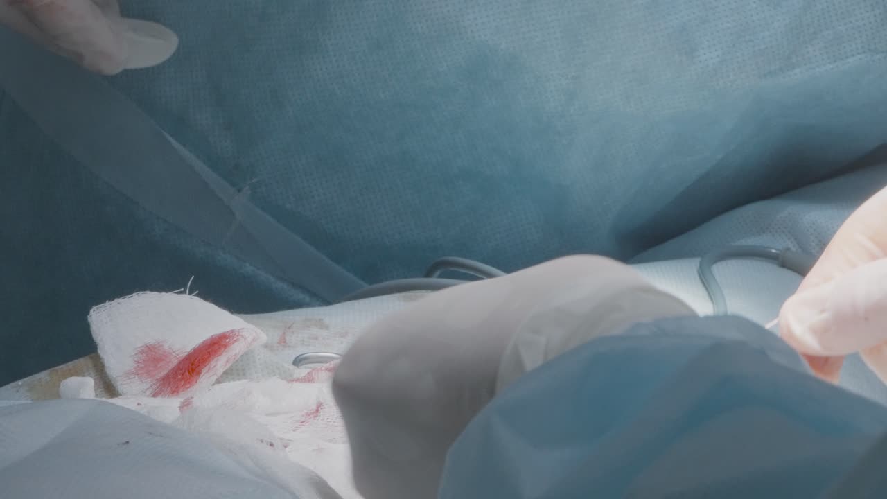 procedimiento quirúrgico