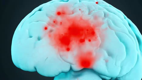 3d illustration of a human brain with red spots