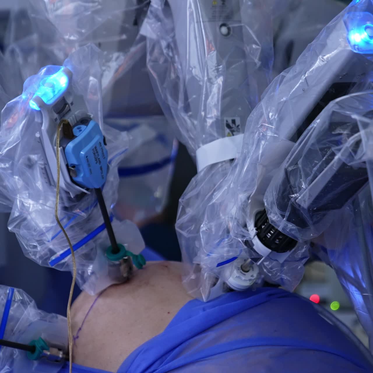 Manipulator active arms input into abdomen move slowly. Robotic futuristic equipment performing surgery