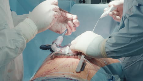 surgeon takes thread with micro forceps. doctor prepares necessary tools for grafting vessels onto coronary arteries. nurse holds vein strippers