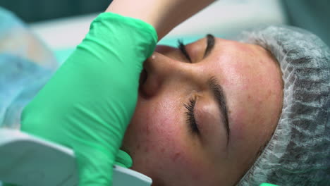 beautician in green gloves removes pimples from client face