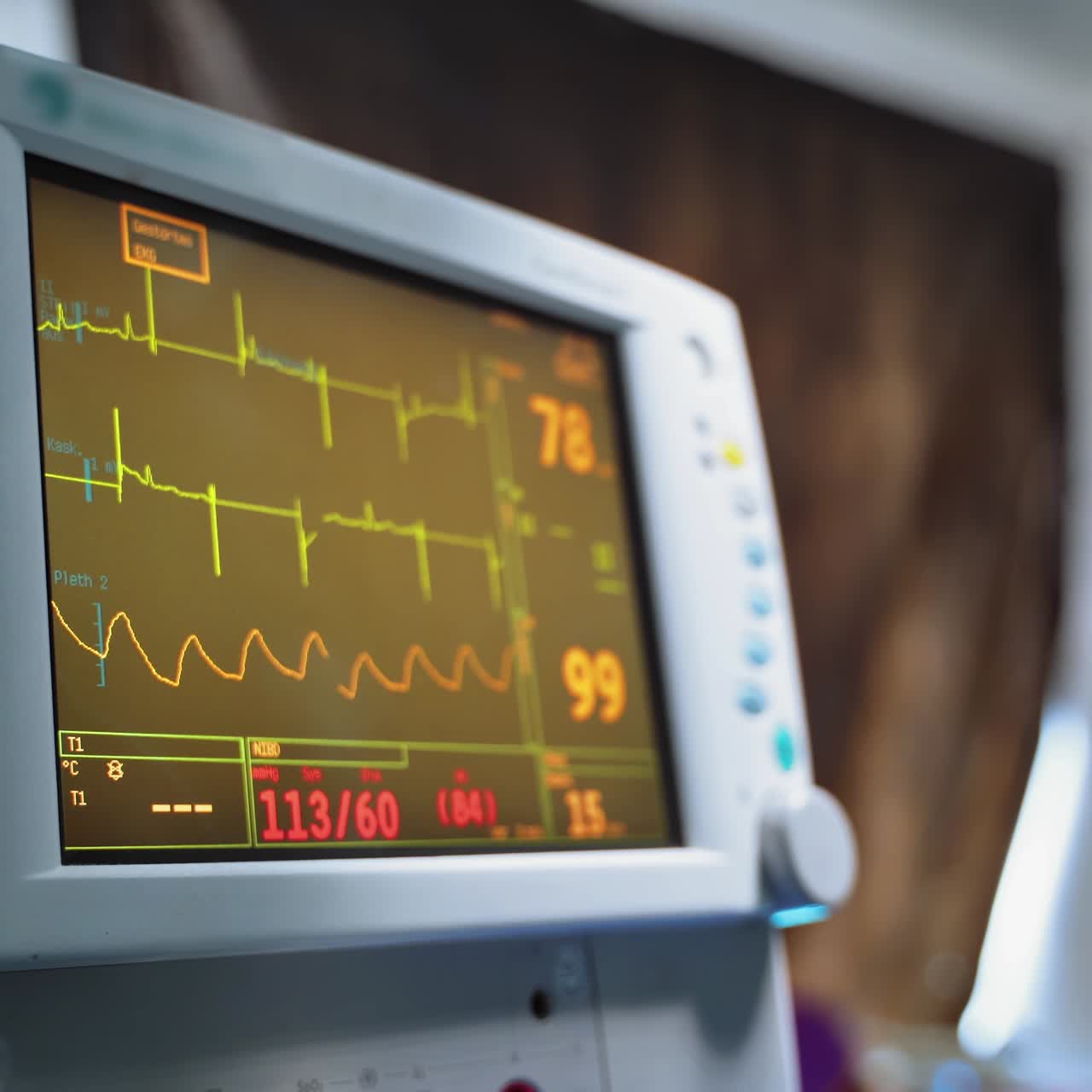 심장 박동 모니터