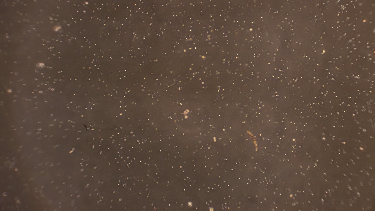 많은 작은 정자 세포가 정액 속에 헤엄치고 있습니다.