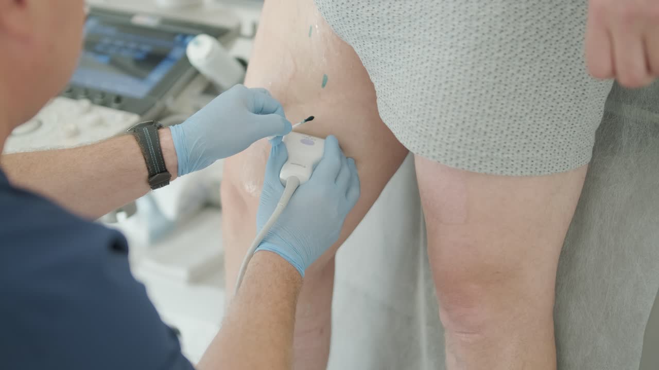 examen por ultrasonido de la úlcera de la pierna en una clínica médica