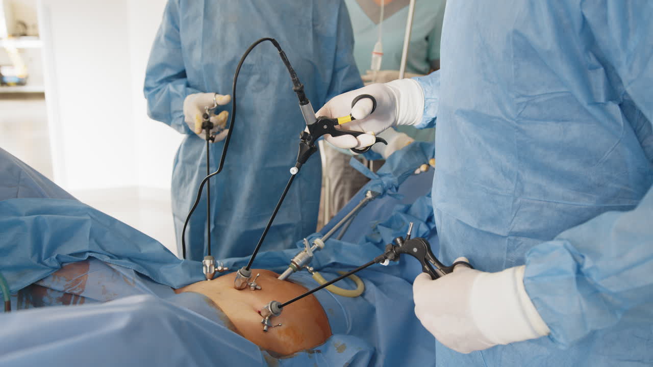 진행 중인 laparoscopic 수술