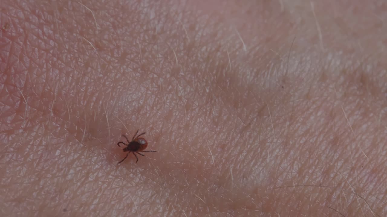 Tick moving across hand showing parasite detail and danger of bacterial infection, closeup