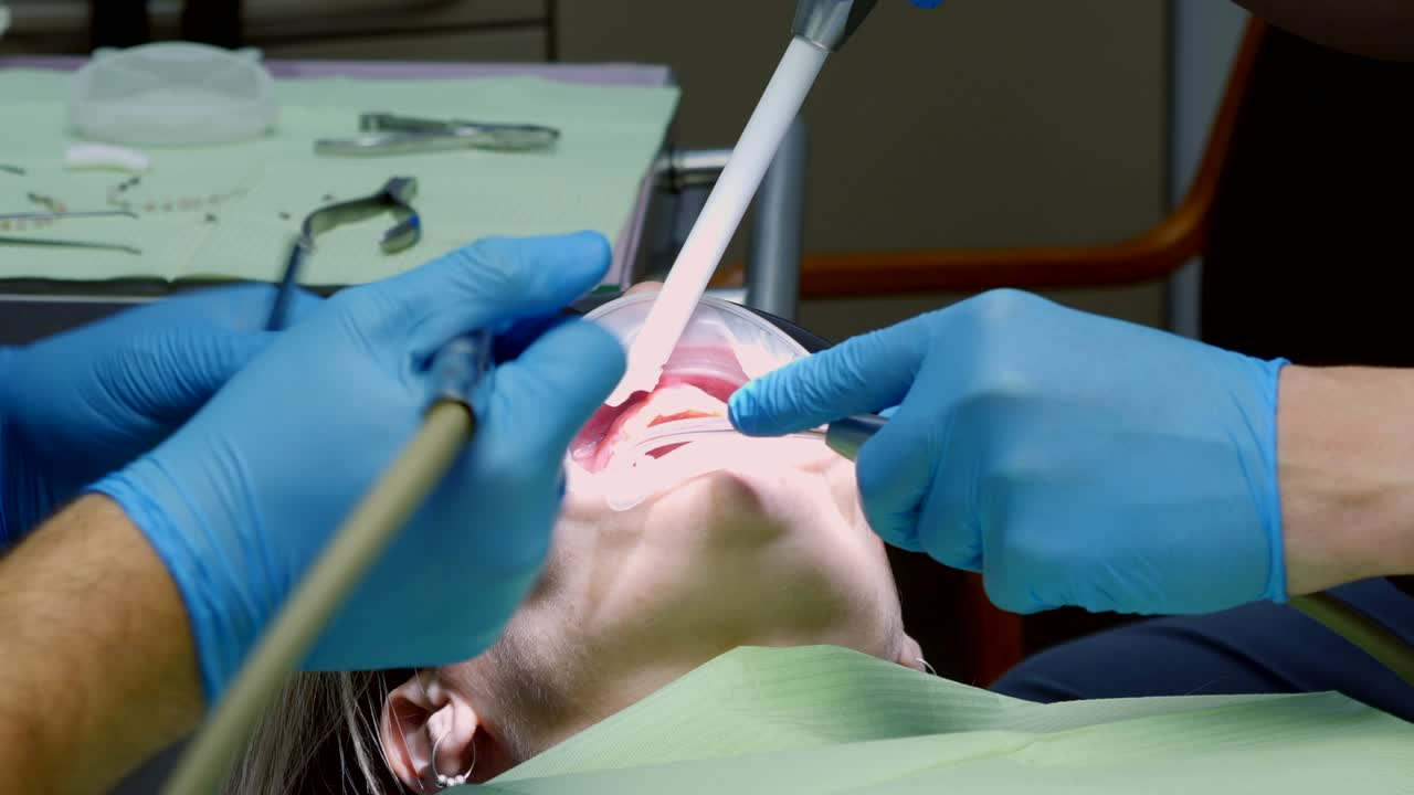 proceso de retiro de brackets