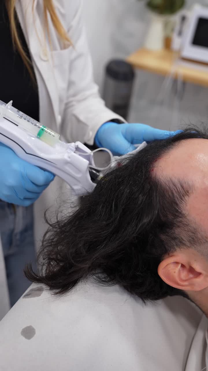 Hair Loss Treatment with Mesotherapy