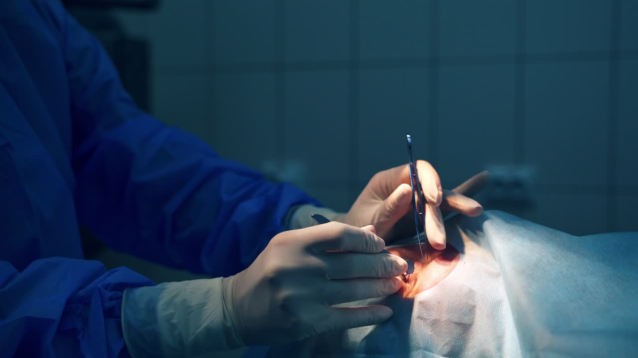 Surgeon operating patient. Surgeon performing operation on the eyes