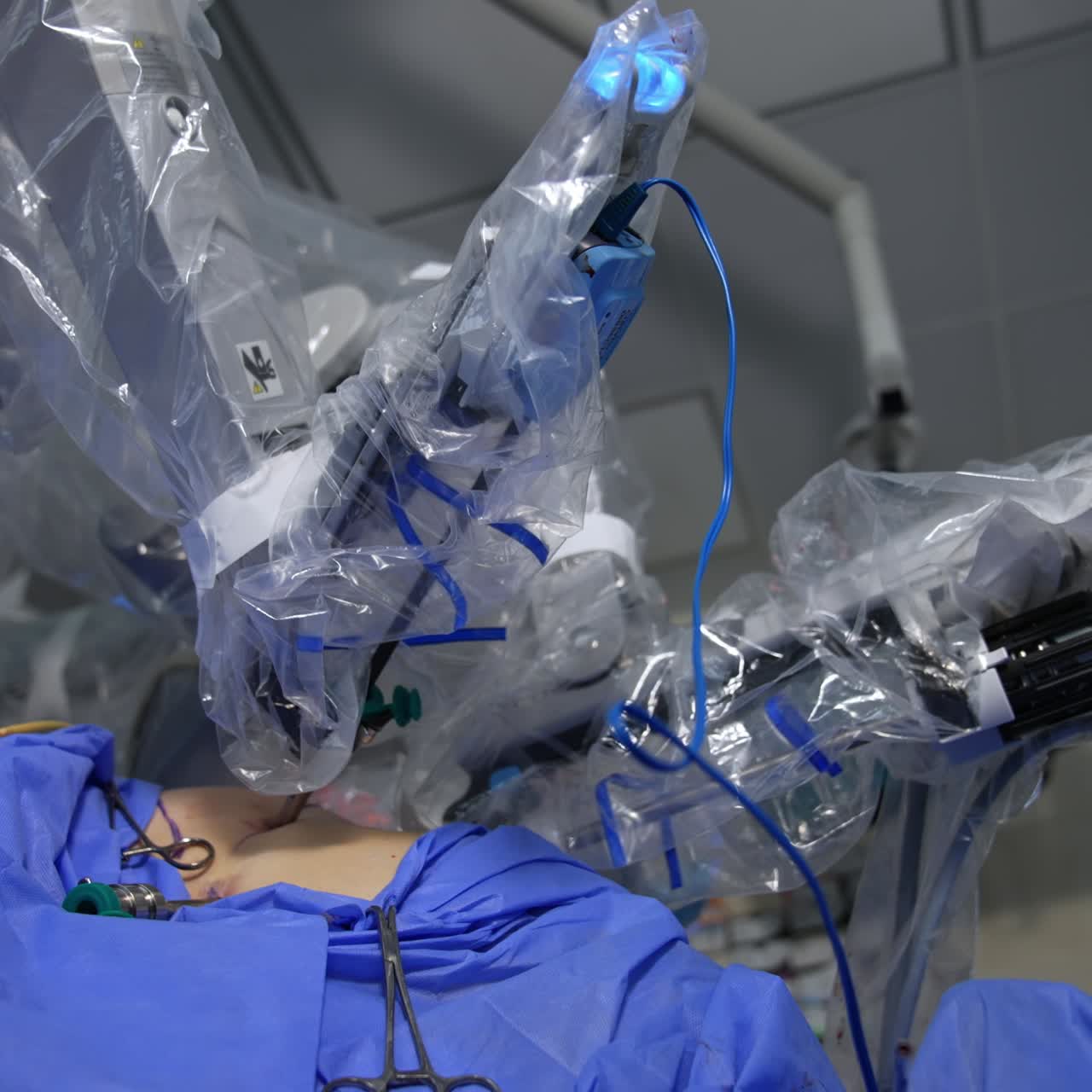 Da Vinci robot manipulator arm input through a little hole into the patient's abdomen. Robot surgeons moves operating the patient. Low angle view