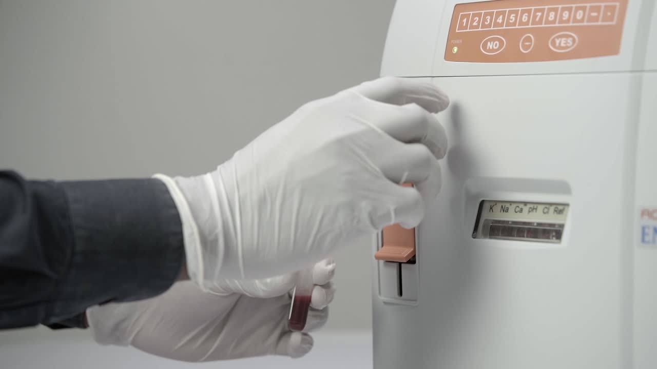 Medical Technologist's Hands In Disposable Gloves Holding Blood Sample In Tube, Push Buttons Of An Electrolyte Analyzer