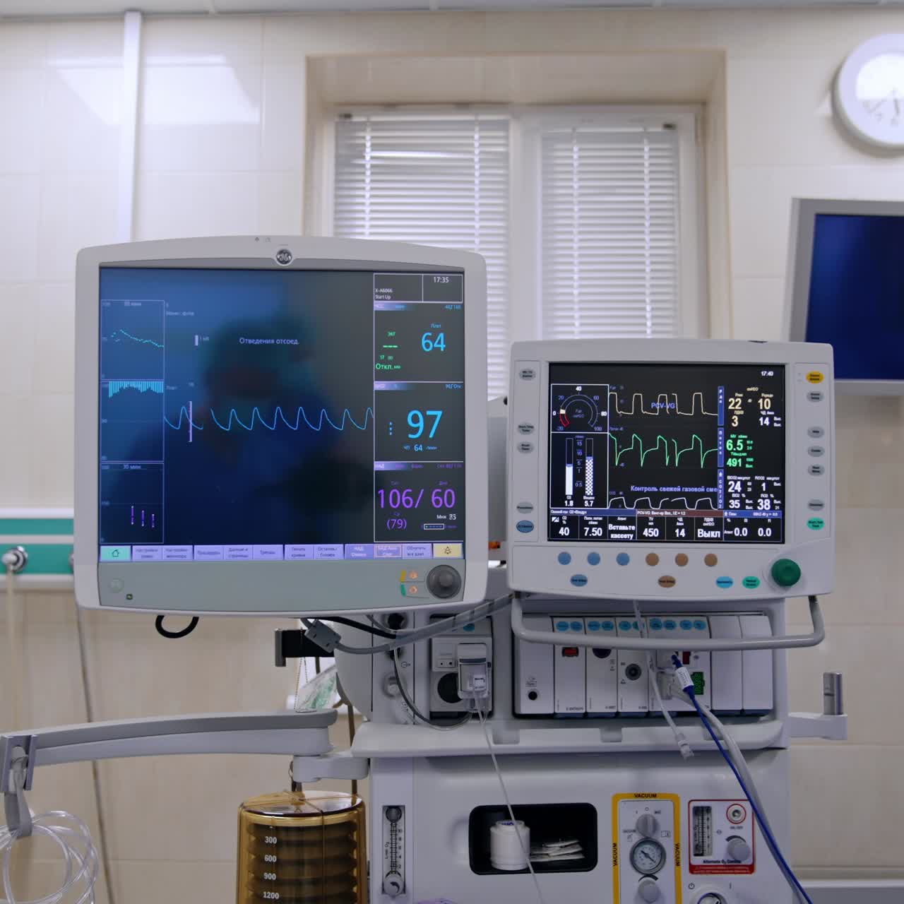 Schermi più grandi e più piccoli di un ventilatore polmonare in funzione in una sala operatoria. I monitor mostrano i parametri vitali di un paziente operato in sala operatoria.