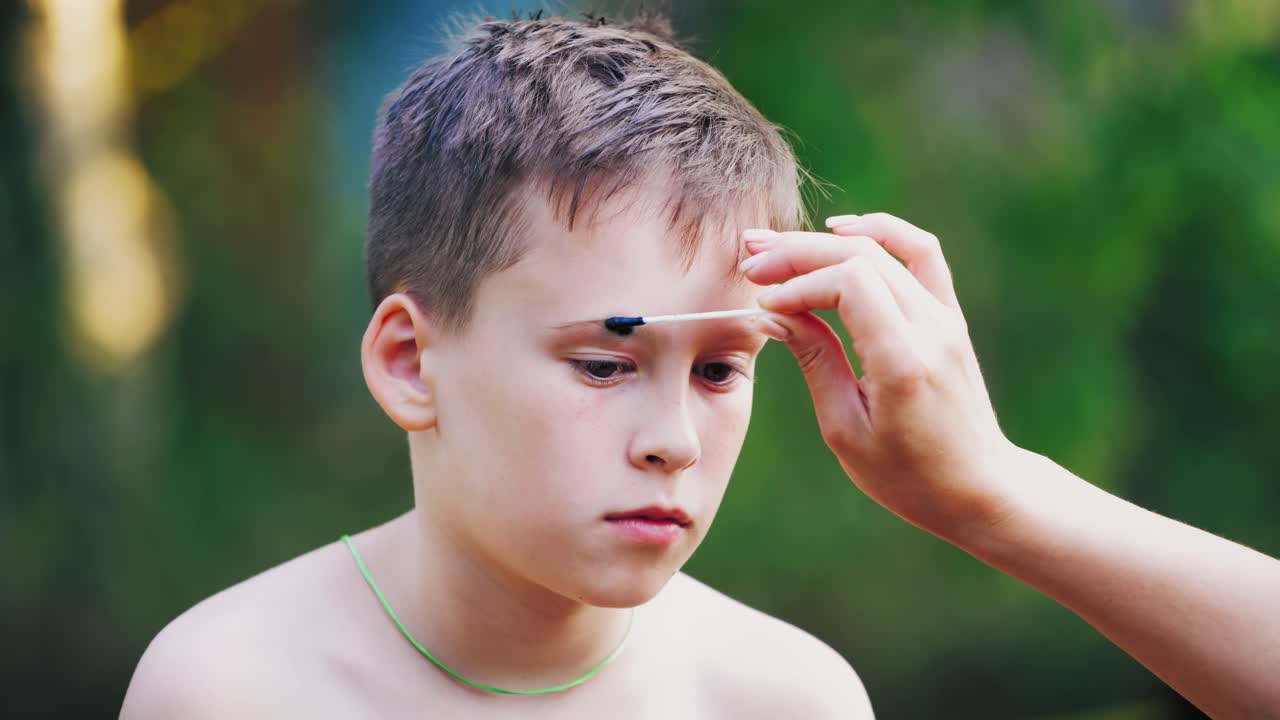 Boy has a open wound on the eyebrow. Mother gives the first aid to her child on face. Naked boy has an injury on his eyebrow and woman's hand treats it outdoors.