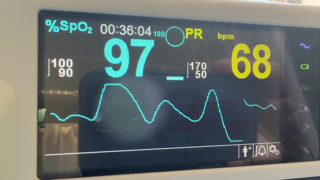 Display di pulsossimetro medico che mostra la saturazione di ossigeno e la frequenza cardiaca