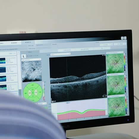 ophthalmologist conducting eye exam with oct scan