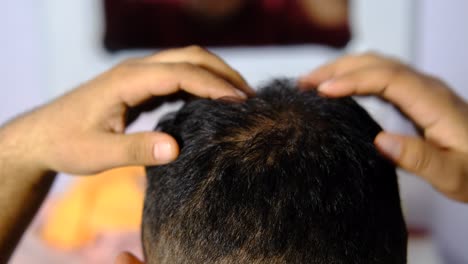 Picazón-En-El-Cabello-Masculino