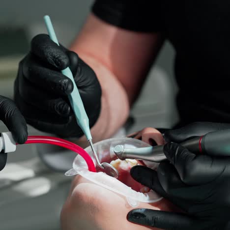 female patient's face with open mouth. hands of dentist in gloves with medical tools treating client's teeth. patient receiving tooth treatment in dental office. close-up.