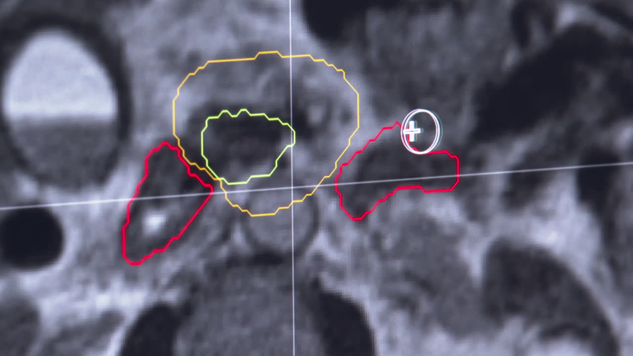 MRI Brain Scan with Marked Regions