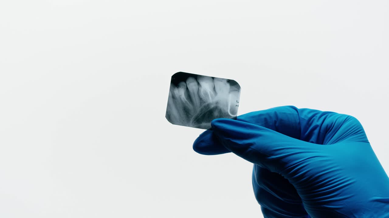 Gloved Hand Holding and Examining a Dental X-Ray Film