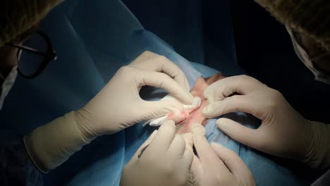 blepharoplasty plastic surgery operation. rejuvenation, modification the eye region