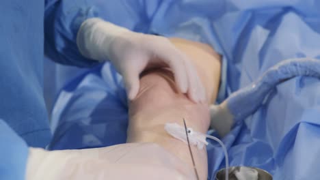 surgical procedure on knee or arm