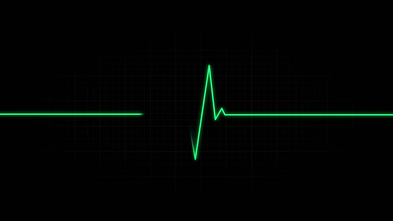EKG Heart Rate Monitor Display for Medical facility Animation