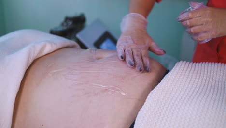 la esteticista aplica gel en el vientre de la mujer con sobrepeso